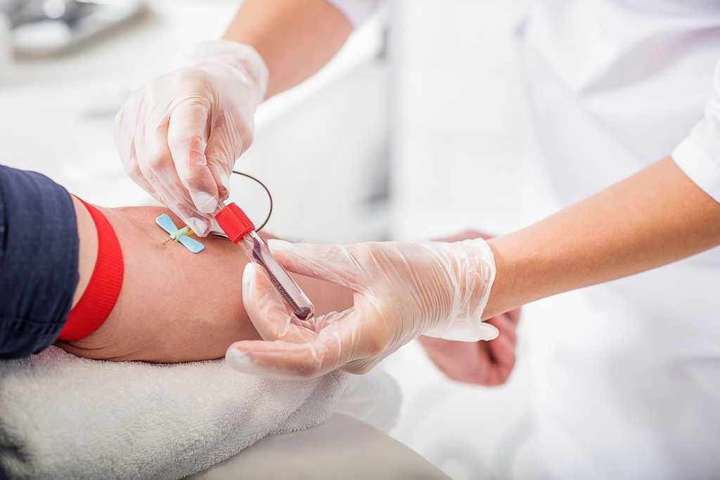 nurse extracting blood from a patient's arm 